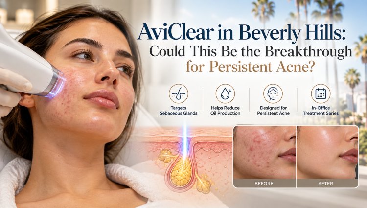 AviClear in Beverly Hills: Could This Be the Breakthrough for Persistent Acne?